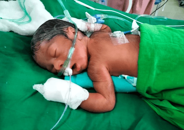 Twin Babies Of Mrs. Samina (3 Days Old Babies)